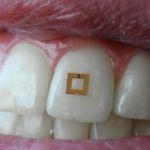 sensor que se adhire a los dientes