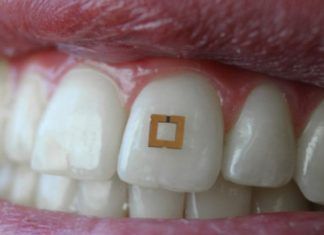 sensor que se adhire a los dientes