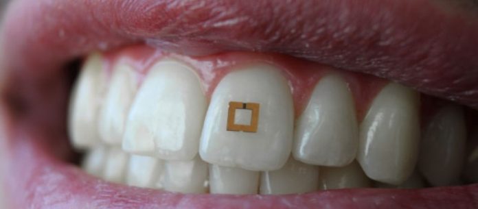 sensor que se adhire a los dientes