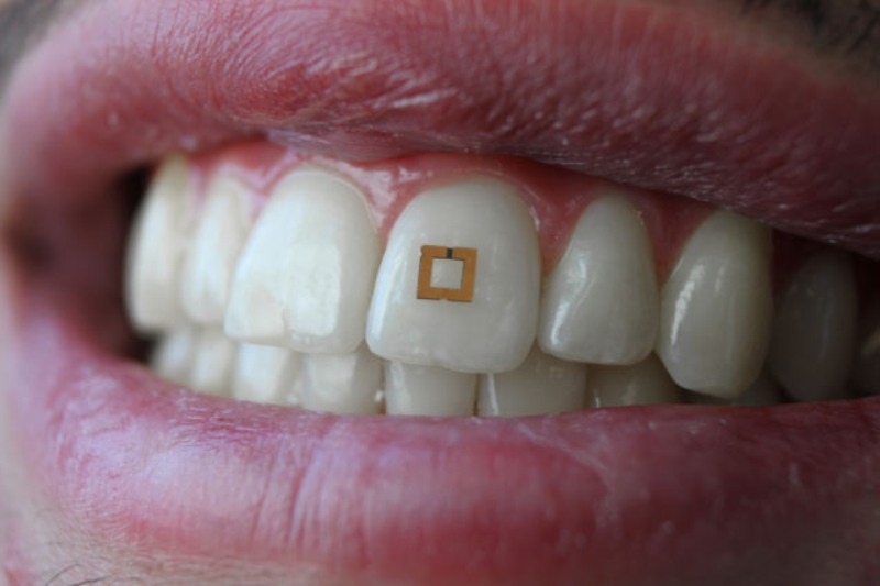 sensor que se adhiere a los dientes