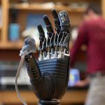 E-dermis, la piel electrónica de prótesis que permite sentir dolor