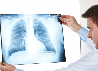 Crearán máquina portátil de rayos X